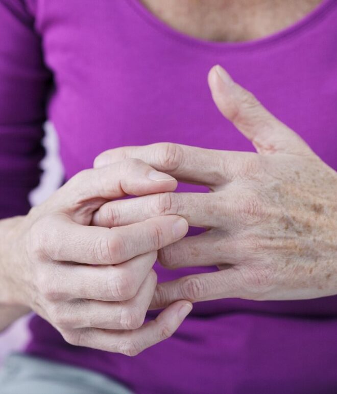 Types of Arthritis Pain Symptoms, Causes & Treatment | Plants AID